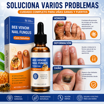 Sérum para Uñas con Veneno de Abeja 50ml – Tratamiento Antihongos y Cuidado Intensivo